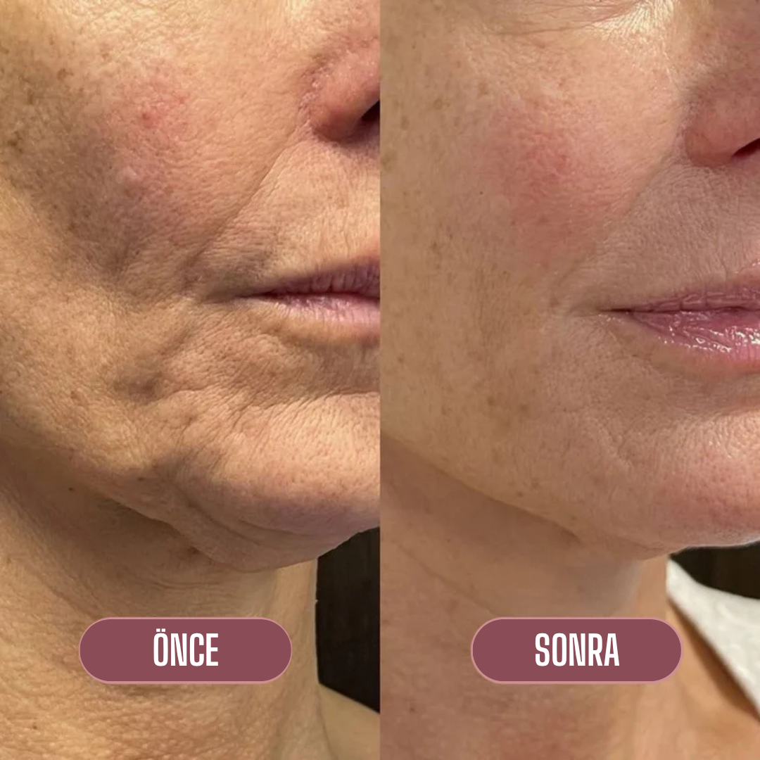 ndn™ Collagen Multi Balm