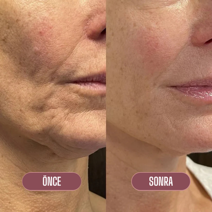 ndn™ Collagen Multi Balm